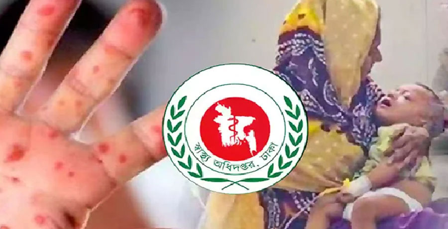 ২৪ ঘণ্টায় হাম ও উপসর্গে আরও ৭ জনের মৃত্যু