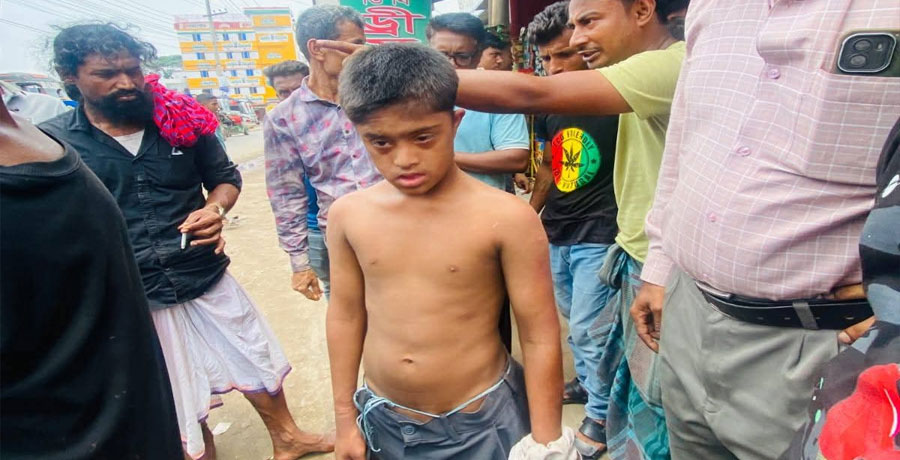 প্রতিবন্ধী শিশুকে অমানবিক নির্যাতন