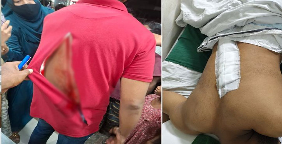 রাজধানীতে ধারালো অস্ত্রের হামলায় আহত এসআই, পিঠে ৪৩ সেলাই