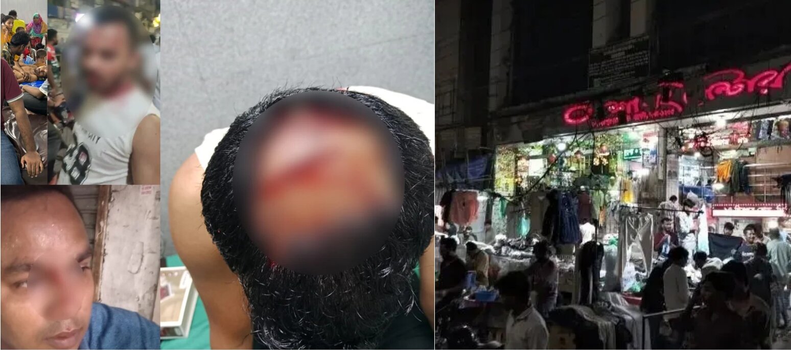   নিউ মার্কেটে চাঁদাবাজিকে কেন্দ্র করে ছাত্রদল-যুবদল সংঘর্ষে আহত ২৫