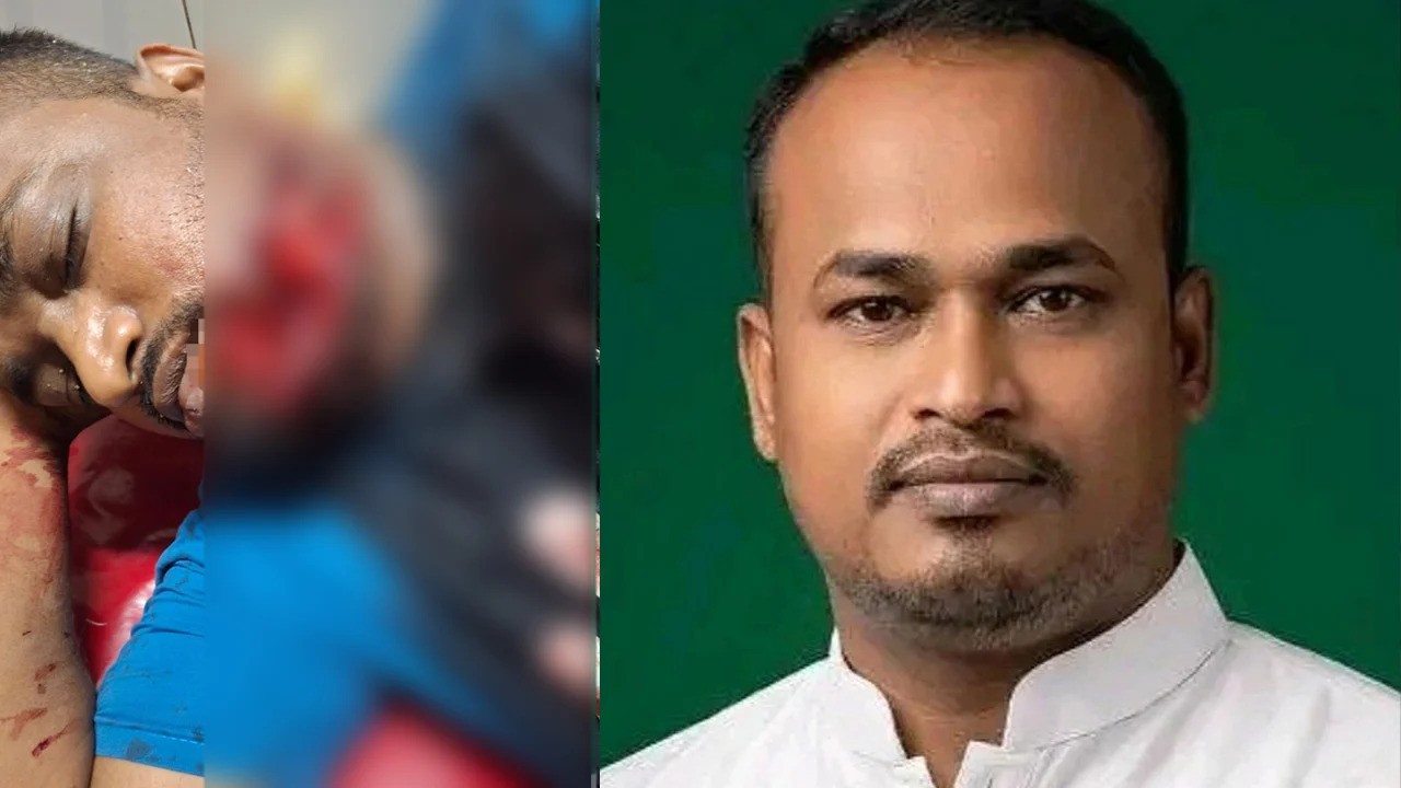  পাবনার ঈশ্বরদীতে স্বেচ্ছাসেবক দলের নেতাকে কুপিয়ে হত্যার চেষ্টা